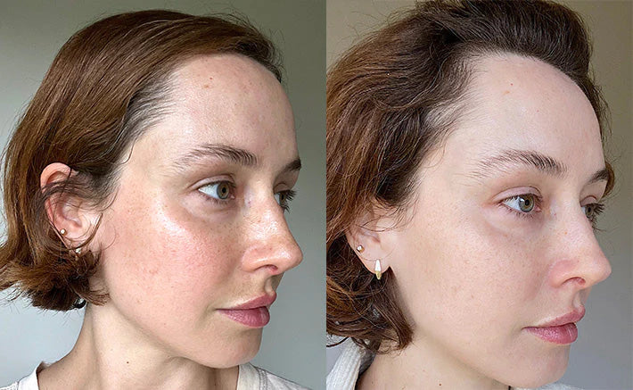 KOSSH PDRN-HYALURONİK ASİT SERUM YOĞUN NEM VE CİLT BAKIM ÜRÜNÜ